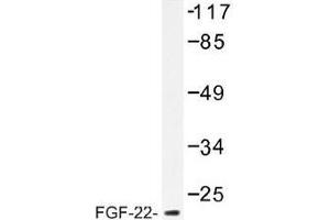 Image no. 1 for anti-Fibroblast Growth Factor 22 (FGF22) antibody (ABIN317810) (FGF22 Antikörper)
