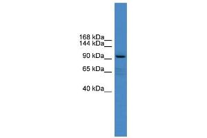 WB Suggested Anti-XYLT1 Antibody Titration:  0. (XYLT1 Antikörper  (Middle Region))
