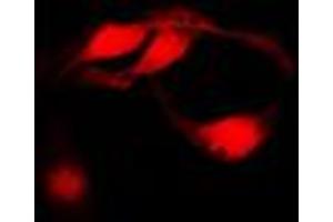 Immunofluorescent analysis of CHK1 staining in HeLa cells. (CHEK1 Antikörper  (Center))