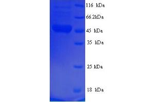 SDS-PAGE (SDS) image for Fused in Sarcoma (FUS) (AA 137-574) protein (His tag) (ABIN5714278) (FUS Protein (AA 137-574) (His tag))