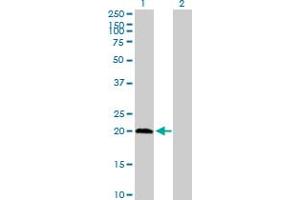 Western Blot analysis of PPCDC expression in transfected 293T cell line by PPCDC MaxPab polyclonal antibody. (PPCDC Antikörper  (AA 1-204))