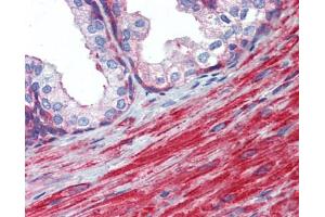 Immunohistochemistry (IHC) image for anti-Myosin Light Chain 6, Alkali, Smooth Muscle and Non Muscle (MYL6) (N-Term) antibody (ABIN2787351)