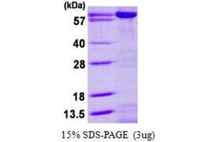 Adenylate Kinase 5 (AK5) (AA 1-562) protein (His tag)