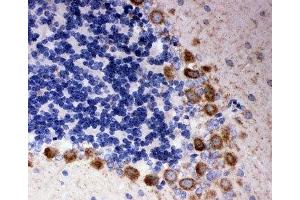 IHC-P: DISC1 antibody testing of rat cerebellum tissue (DISC1 Antikörper  (Middle Region))