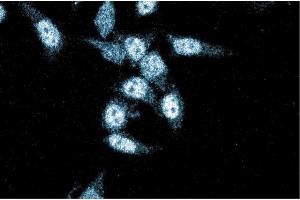 Immunofluorescence staining of HeLa cells (Human cervical epitheloid carcinoma, ATCC CCL-2. (XRCC4 Antikörper  (AA 53-168))
