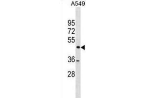 Western Blotting (WB) image for anti-TSPY-Like 1 (TSPYL1) antibody (ABIN3001083) (TSPYL1 Antikörper)