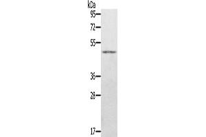Western Blotting (WB) image for anti-Jumonji Domain Containing 5 (JMJD5) antibody (ABIN2423683) (JMJD5 Antikörper)