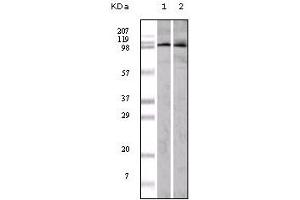Western Blotting (WB) image for anti-Ephrin Type A Receptor 1 (EPHA1) (truncated) antibody (ABIN2464049) (EPHA1 Antikörper  (truncated))