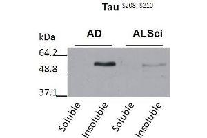 Western blot detection of insoluble phospho-Tau protein using the anti-Tau (Ser 208/210) antibody in samples isolated from patients with a neurodegenerative disease (Amyotropic lateral sclerosis, ALS or Alzheimer’s disease, AD (tau Antikörper  (pSer208, pSer210))