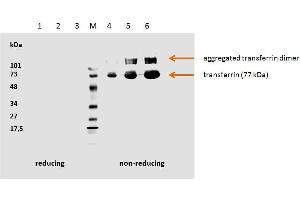 Human transferrin detected by the mouse monoclonal antibody HTF-14. (Transferrin Antikörper)