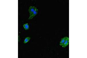 Immunofluorescent analysis of HepG2 cells using ABIN7143724 at dilution of 1:100 and Alexa Fluor 488-congugated AffiniPure Goat Anti-Rabbit IgG(H+L) (Allergin-1 Antikörper  (AA 249-343))