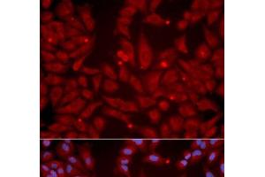 Immunofluorescence analysis of U2OS cells using GRIK2 Polyclonal Antibody (GRIK2 Antikörper)