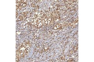 IHC analysis of Sm-D3/SNRPD3 using anti-Sm-D3/SNRPD3 antibody (ABIN7598952).