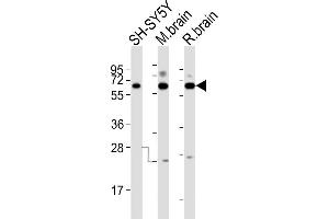 All lanes : Anti-DPYSL5 Antibody (C-term) at 1:2000 dilution Lane 1: SH-SY5Y whole cell lysates Lane 2: mouse brain lysates Lane 3: rat brain lysates Lysates/proteins at 20 μg per lane.