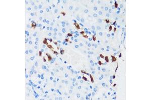 Immunohistochemistry (IHC) image for anti-ATPase, H+ Transporting, Lysosomal 13kDa, V1 Subunit G3 (ATP6V1G3) (AA 1-118) antibody (ABIN7265759)