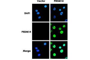Immunofluorescence analysis of PRDM14 in breast cancer cells. (PRDM14 Antikörper  (N-Term))