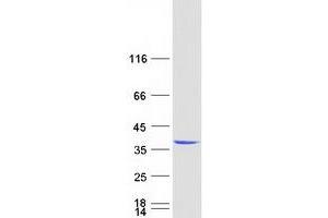 Western Blotting (WB) image for Exosome Component 3 (EXOSC3) (Transcript Variant 1) protein (Myc-DYKDDDDK Tag) (ABIN2720624)