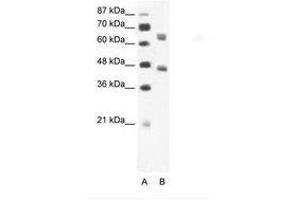 Image no. 1 for anti-RRN3 RNA Polymerase I Transcription Factor (RRN3) (AA 331-380) antibody (ABIN202852) (RRN3 Antikörper  (AA 331-380))