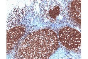 Pax-5 (clone 24) staining on human tonsil. (PAX5 Antikörper  (AA 151-306))