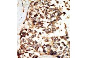Image no. 2 for anti-Protein Kinase D2 (PKD2) (C-Term) antibody (ABIN360330) (PKD2 Antikörper  (C-Term))