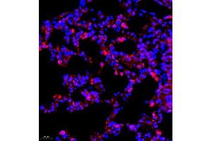 Immunofluorescence of paraffin embedded rat pneumonia using CCR2 (ABIN7073453) at dilution of 1:800 (400x lens) (CCR2 Antikörper)