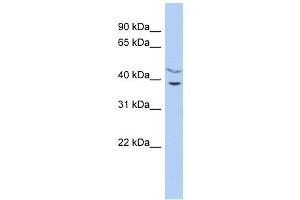 C11ORF77 antibody used at 1 ug/ml to detect target protein. (HARBI1 Antikörper  (Middle Region))