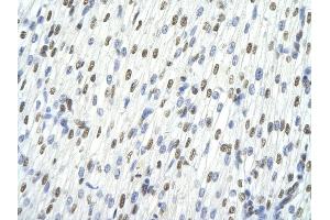 Immunohistochemistry (IHC) image for anti-TAR DNA Binding Protein (TARDBP) (C-Term) antibody (ABIN2780849)