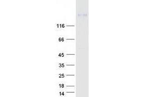 WNK4 Protein (Myc-DYKDDDDK Tag)