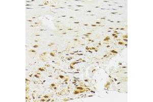 Immunohistochemistry of paraffin-embedded human stomach using EFTUD2 Antibody (ABIN5974236) at dilution of 1/100 (40x lens). (EFTUD2 Antikörper)