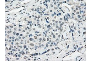 Image no. 1 for anti-Synovial Sarcoma, X Breakpoint 2 (SSX2) antibody (ABIN1501161)