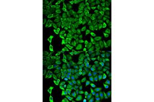 Immunofluorescence (IF) image for anti-Proteasome (Prosome, Macropain) 26S Subunit, Non-ATPase, 2 (PSMD2) antibody (ABIN1874389) (PSMD2 Antikörper)