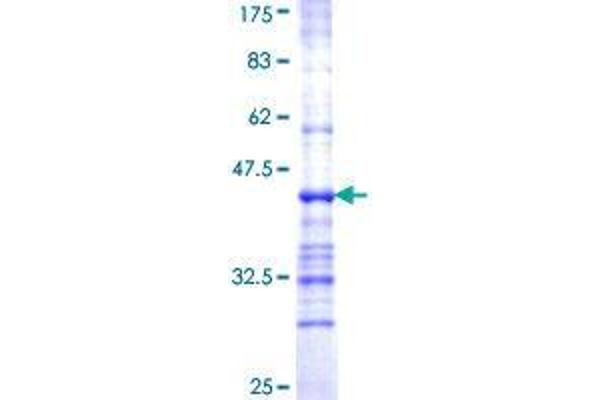 ALG2 Protein (AA 317-416) (GST tag)