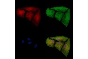 Phospho-TIRAP (Tyr106) Antibody staining A549 cells(heat shock treatment) by IF/ICC.