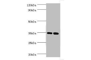Western blot All lanes: MAGEA6 antibody at 7 μg/mL Lane 1: Rat brain tissue Lane 2: Rat gonad tissue Secondary Goat polyclonal to rabbit IgG at 1/10000 dilution Predicted band size: 35 kDa Observed band size: 35 kDa (MAGEA6 Antikörper  (AA 75-314))