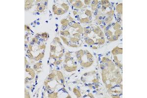 Immunohistochemistry of paraffin-embedded human gastric using PSPH antibody at dilution of 1:100 (x40 lens).