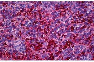 Human Spleen: Formalin-Fixed, Paraffin-Embedded (FFPE) (XCL1 Antikörper  (AA 22-114))