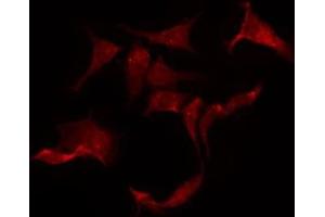 ABIN6275305 staining HeLa by IF/ICC. (CHRNA10 Antikörper  (C-Term))