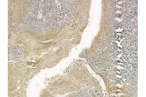 ABIN6258102 and ABIN6273682 at 1/100 staining human normal tonsil tissue by IHC-P. (Keratin 36 Antikörper  (Internal Region))