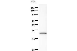 Western Blotting (WB) image for anti-SUMO1 Activating Enzyme Subunit 1 (SAE1) antibody (ABIN931206) (SAE1 Antikörper)