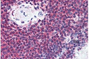 Human Spleen (formalin-fixed, paraffin-embedded) stained with MIF antibody ABIN305887 at 5 ug/ml followed by biotinylated anti-mouse IgG secondary antibody ABIN481714, alkaline phosphatase-streptavidin and chromogen. (MIF Antikörper  (AA 1-114))