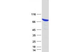 Validation with Western Blot (ESRP1 Protein (Transcript Variant 2) (Myc-DYKDDDDK Tag))