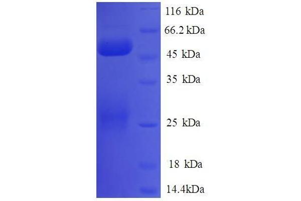 COBRA1 Protein (AA 8-199, partial) (GST tag)