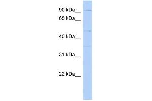 WB Suggested Anti-DPY19L2 Antibody Titration: 0. (DPY19L2 Antikörper  (Middle Region))