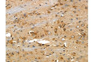 ABIN6257883 and ABIN6275262 at 1/100 staining Rat brain tissue by IHC-P. (MYOM2 Antikörper  (Internal Region))