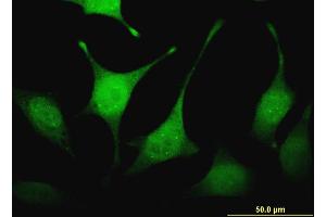 Immunofluorescence of monoclonal antibody to FBXW4P1 on HeLa cell. (FBXW4P1 Antikörper  (AA 31-130))