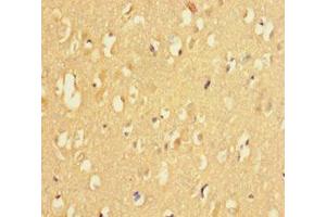 Immunohistochemistry of paraffin-embedded human brain tissue using ABIN7158695 at dilution of 1:100