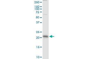 RAB13 monoclonal antibody (M01), clone 8H8. (RAB13 Antikörper  (AA 1-203))