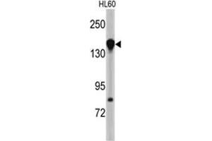 Western blot analysis of NUP155 antibody (N-term) in HL60 cell line lysates (35ug/lane).