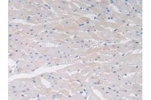 Detection of CCK in Rat Heart Tissue using Polyclonal Antibody to Cholecystokinin (CCK) (Cholecystokinin Antikörper  (AA 1-115))
