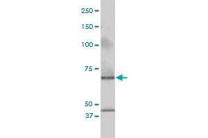 CSTF2 monoclonal antibody (M01), clone 3D1-3A6 Western Blot analysis of CSTF2 expression in Jurkat .